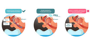 Les Risques de l'Apnée du Sommeil